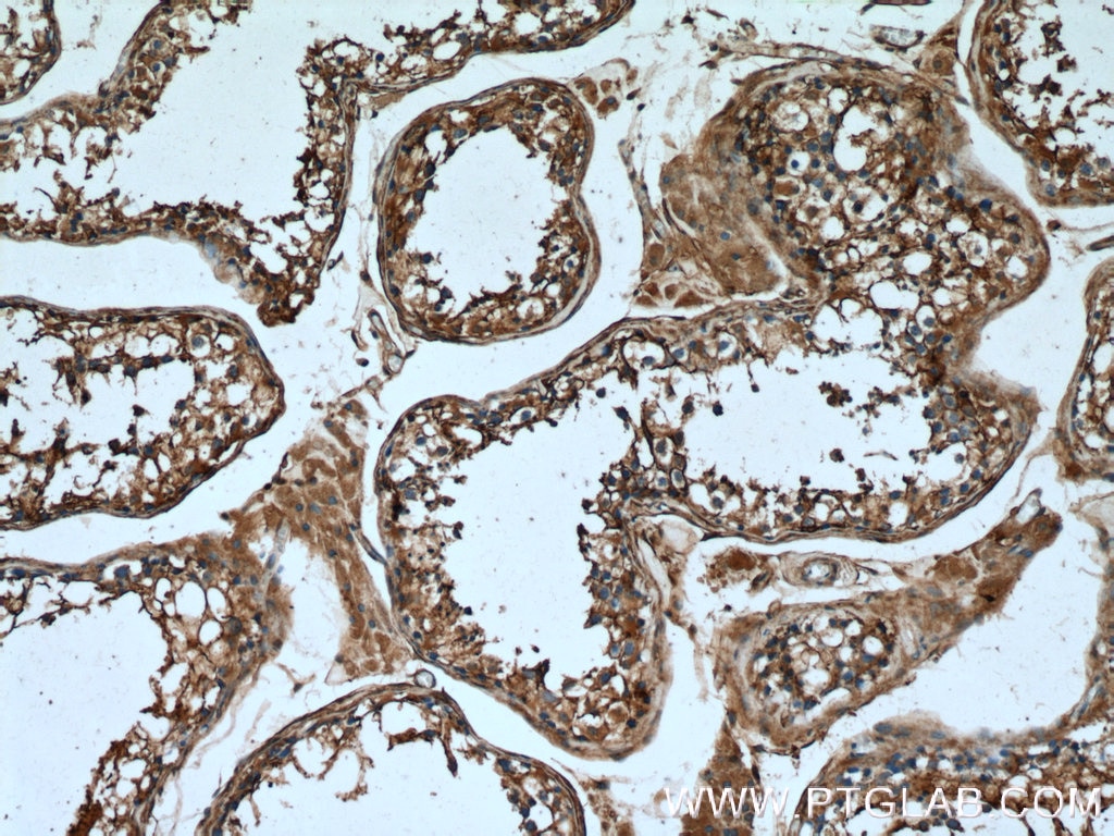 Immunohistochemistry (IHC) staining of human testis tissue using Annexin VI Polyclonal antibody (12542-1-AP)