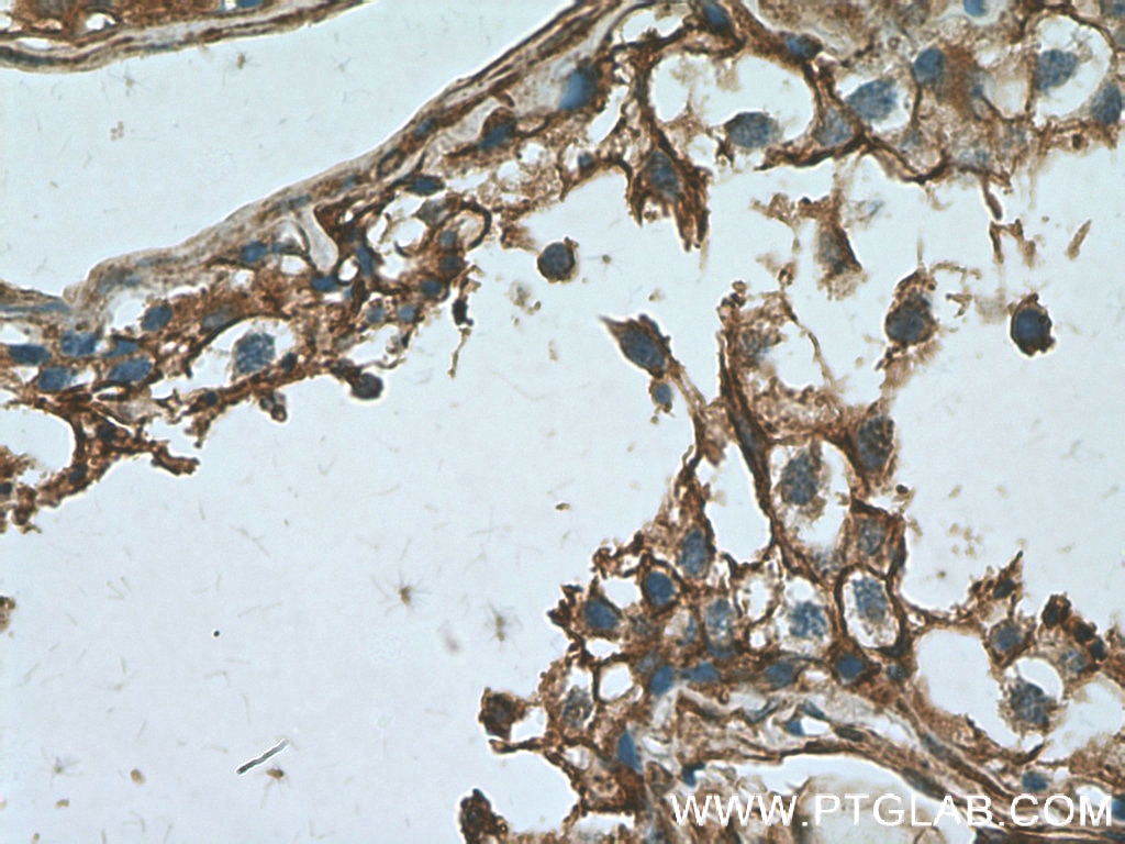 Immunohistochemistry (IHC) staining of human testis tissue using Annexin VI Polyclonal antibody (12542-1-AP)