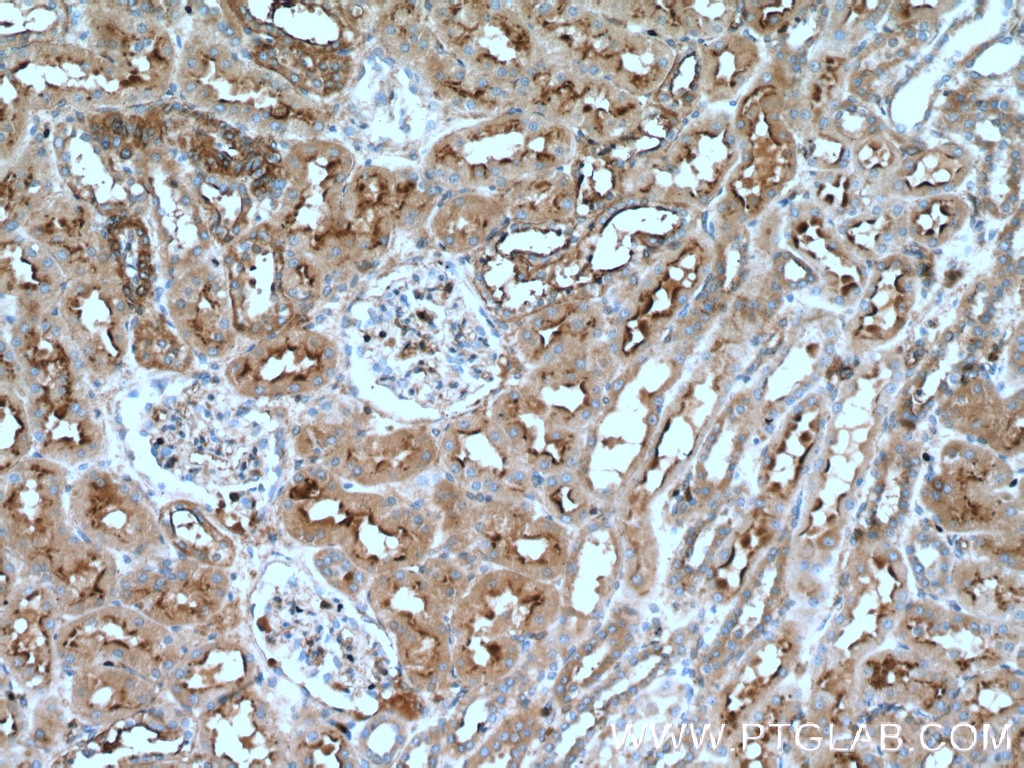 Immunohistochemistry (IHC) staining of human kidney tissue using Annexin VI Polyclonal antibody (12542-1-AP)
