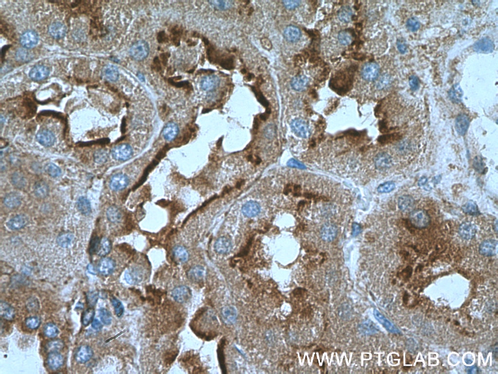 Immunohistochemistry (IHC) staining of human kidney tissue using Annexin VI Polyclonal antibody (12542-1-AP)