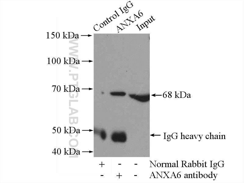 Immunoprecipitation (IP) experiment of mouse kidney tissue using Annexin VI Polyclonal antibody (12542-1-AP)