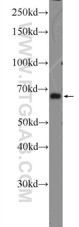 Western Blot (WB) analysis of A549 cells using Annexin VI Polyclonal antibody (12542-1-AP)