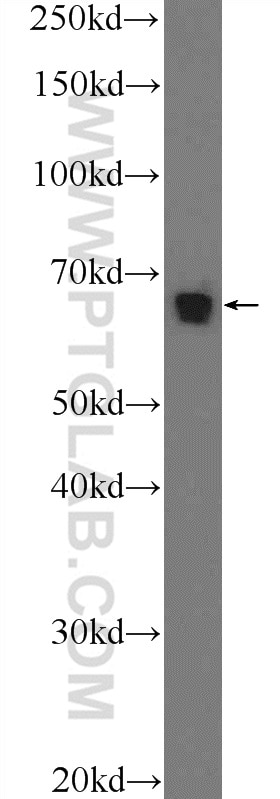 Western Blot (WB) analysis of Jurkat cells using Annexin VI Polyclonal antibody (12542-1-AP)