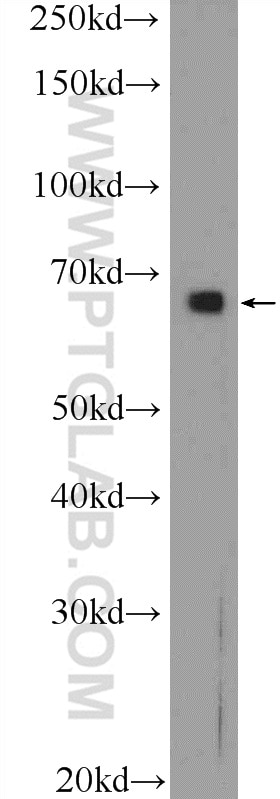 Western Blot (WB) analysis of HeLa cells using Annexin VI Polyclonal antibody (12542-1-AP)