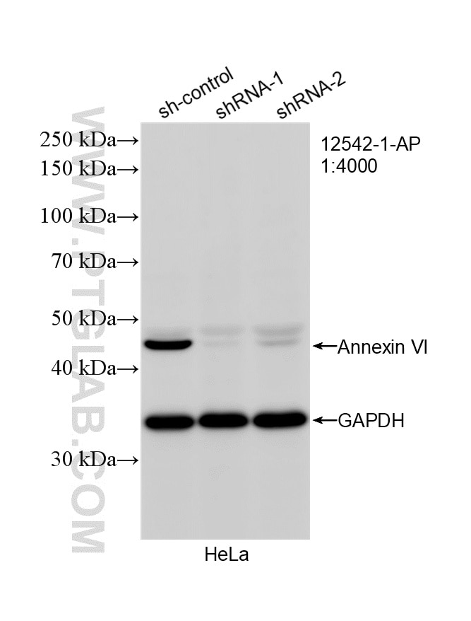 Western Blot (WB) analysis of HeLa cells using Annexin VI Polyclonal antibody (12542-1-AP)