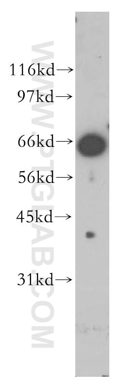 Western Blot (WB) analysis of human brain tissue using Annexin VI Polyclonal antibody (12542-1-AP)