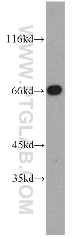 Western Blot (WB) analysis of HeLa cells using Annexin VI Polyclonal antibody (12542-1-AP)