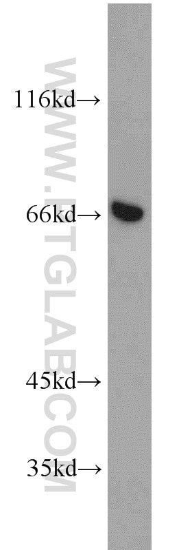 Western Blot (WB) analysis of mouse placenta tissue using Annexin VI Polyclonal antibody (12542-1-AP)