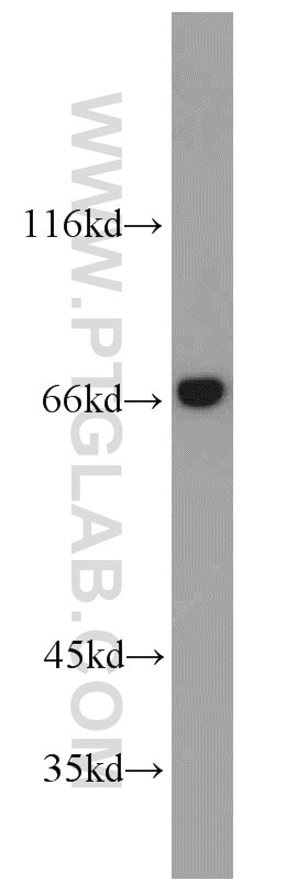 Western Blot (WB) analysis of mouse kidney tissue using Annexin VI Polyclonal antibody (12542-1-AP)
