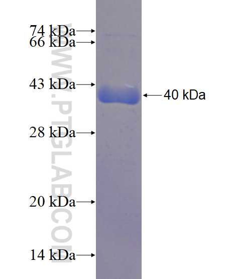 ANXA6 fusion protein Ag3263 SDS-PAGE