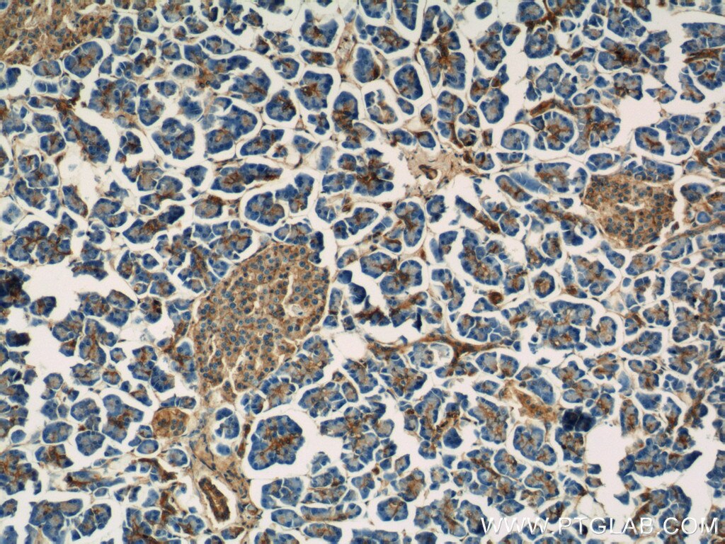 Immunohistochemistry (IHC) staining of human pancreas tissue using Annexin A7  Polyclonal antibody (10154-2-AP)