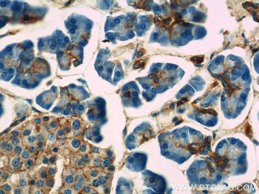 Immunohistochemistry (IHC) staining of human pancreas tissue using Annexin A7  Polyclonal antibody (10154-2-AP)