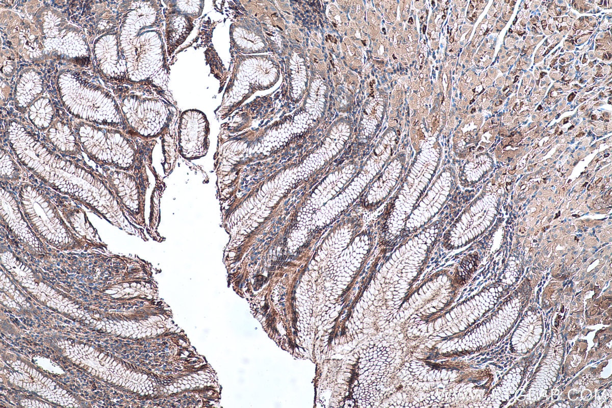 Immunohistochemistry (IHC) staining of human stomach tissue using Annexin A7  Polyclonal antibody (10154-2-AP)