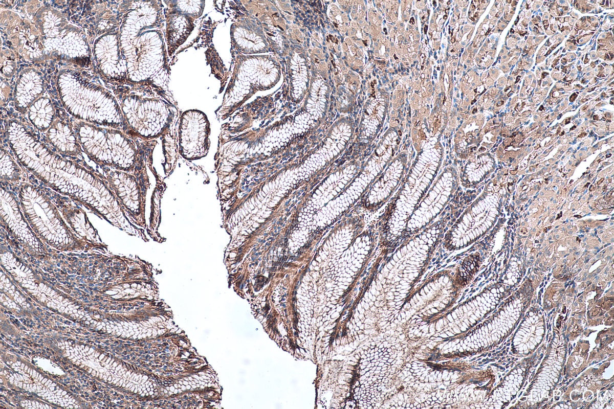 IHC staining of human stomach using 10154-2-AP