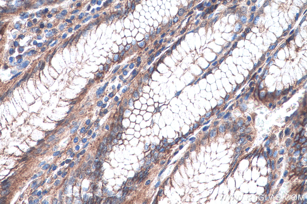 Immunohistochemistry (IHC) staining of human stomach tissue using Annexin A7  Polyclonal antibody (10154-2-AP)