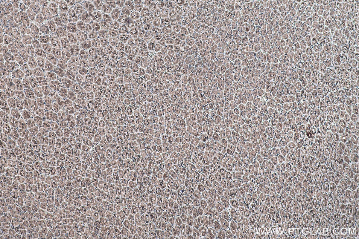 Immunohistochemistry (IHC) staining of rat stomach tissue using Annexin A7  Polyclonal antibody (10154-2-AP)