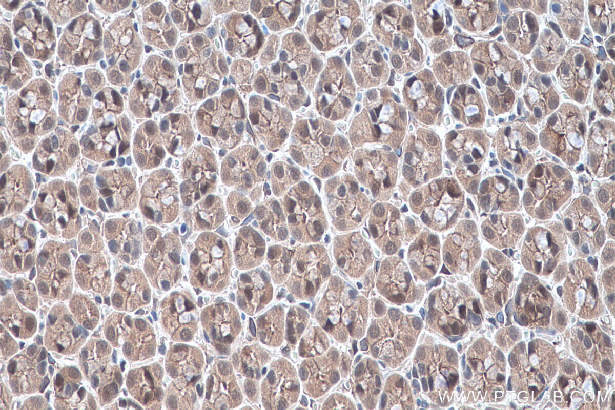 IHC staining of rat stomach using 10154-2-AP