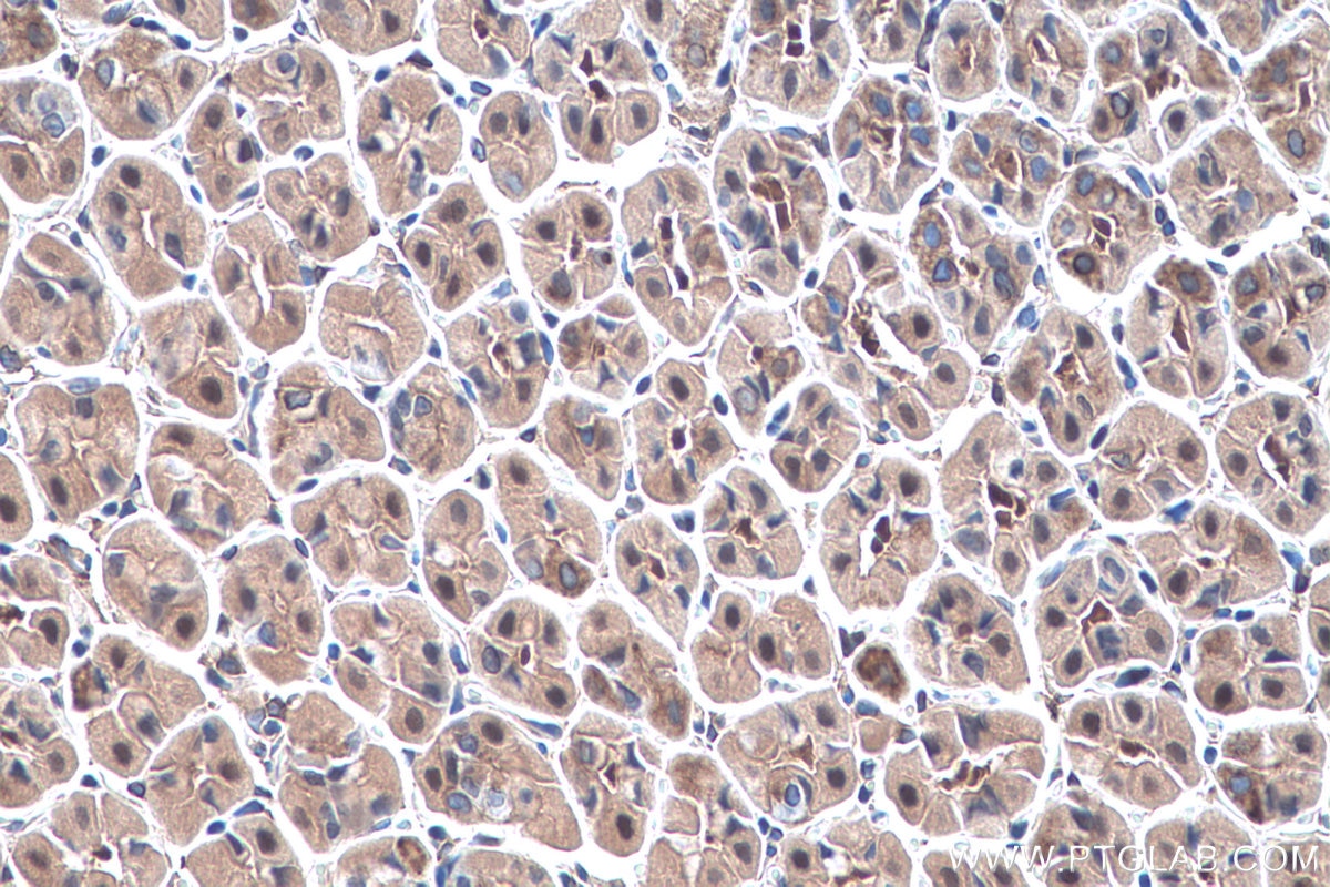 Immunohistochemistry (IHC) staining of mouse stomach tissue using Annexin A7  Polyclonal antibody (10154-2-AP)