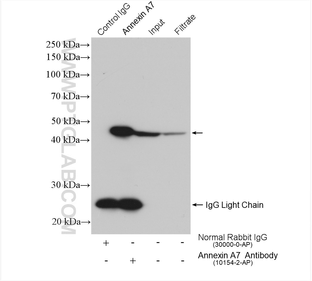 Immunoprecipitation (IP) experiment of U-87 MG cells using Annexin A7  Polyclonal antibody (10154-2-AP)