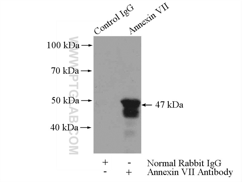 Immunoprecipitation (IP) experiment of mouse heart tissue using Annexin A7  Polyclonal antibody (10154-2-AP)