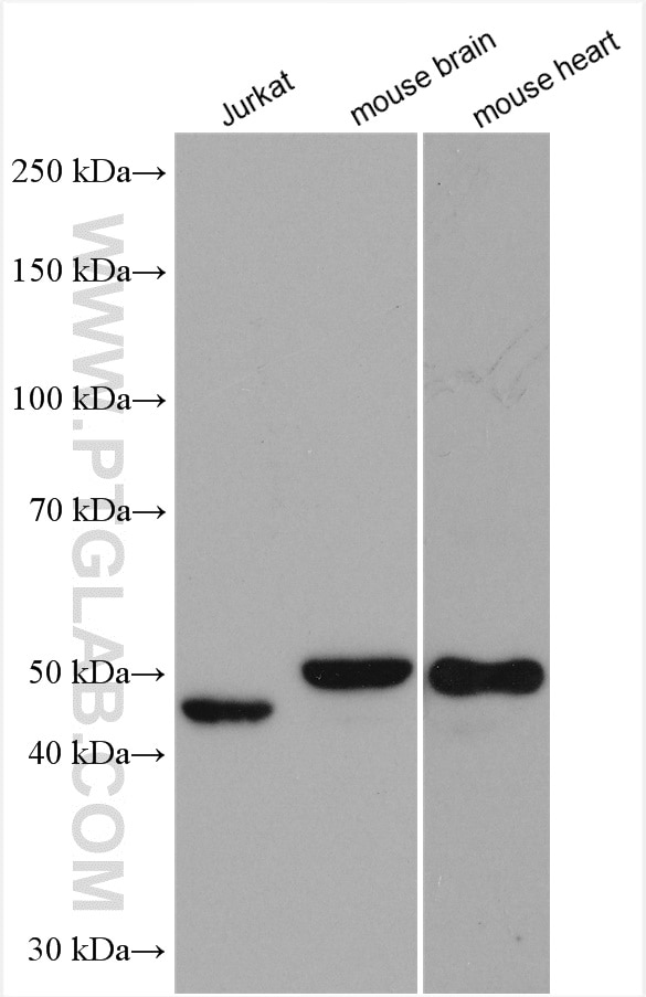 Western Blot (WB) analysis of various lysates using Annexin A7  Polyclonal antibody (10154-2-AP)