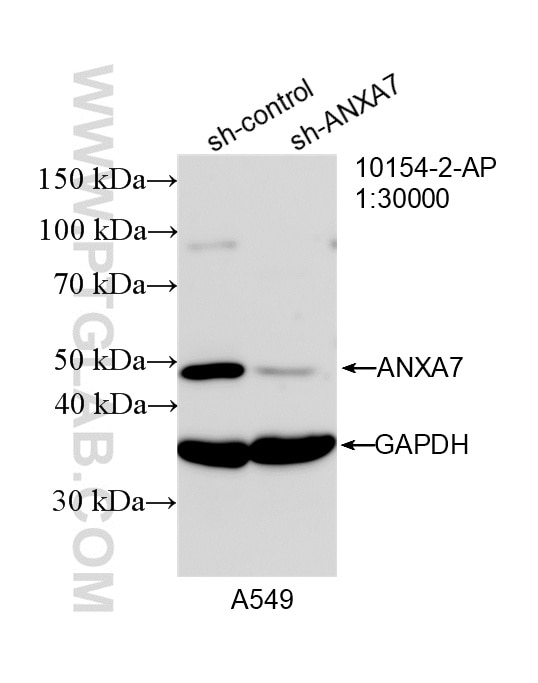 Western Blot (WB) analysis of A549 cells using Annexin A7 Polyclonal antibody (10154-2-AP)