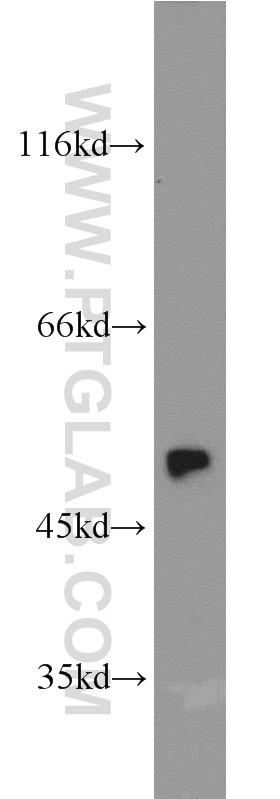 Western Blot (WB) analysis of mouse lung tissue using Annexin A7  Polyclonal antibody (10154-2-AP)