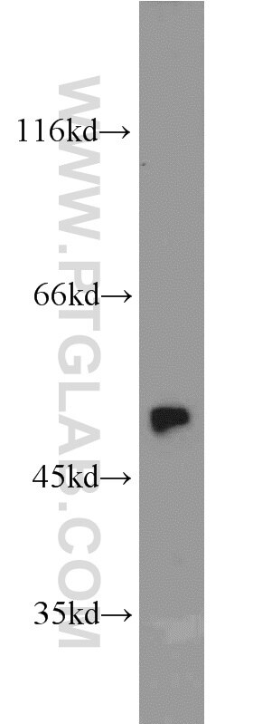 Western Blot (WB) analysis of mouse lung tissue using Annexin A7  Polyclonal antibody (10154-2-AP)