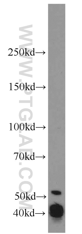 WB analysis of L02 using 10154-2-AP