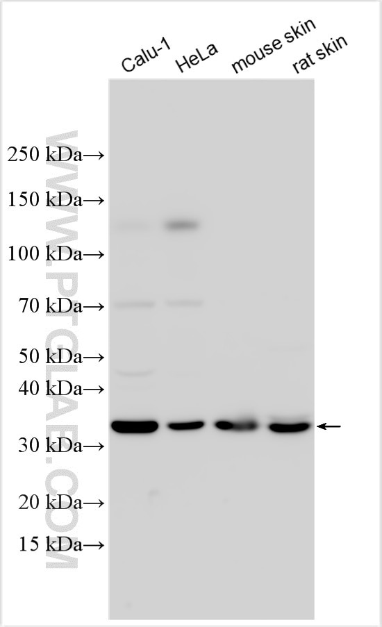 Western Blot (WB) analysis of various lysates using ANXA8 Polyclonal antibody (33144-1-AP)