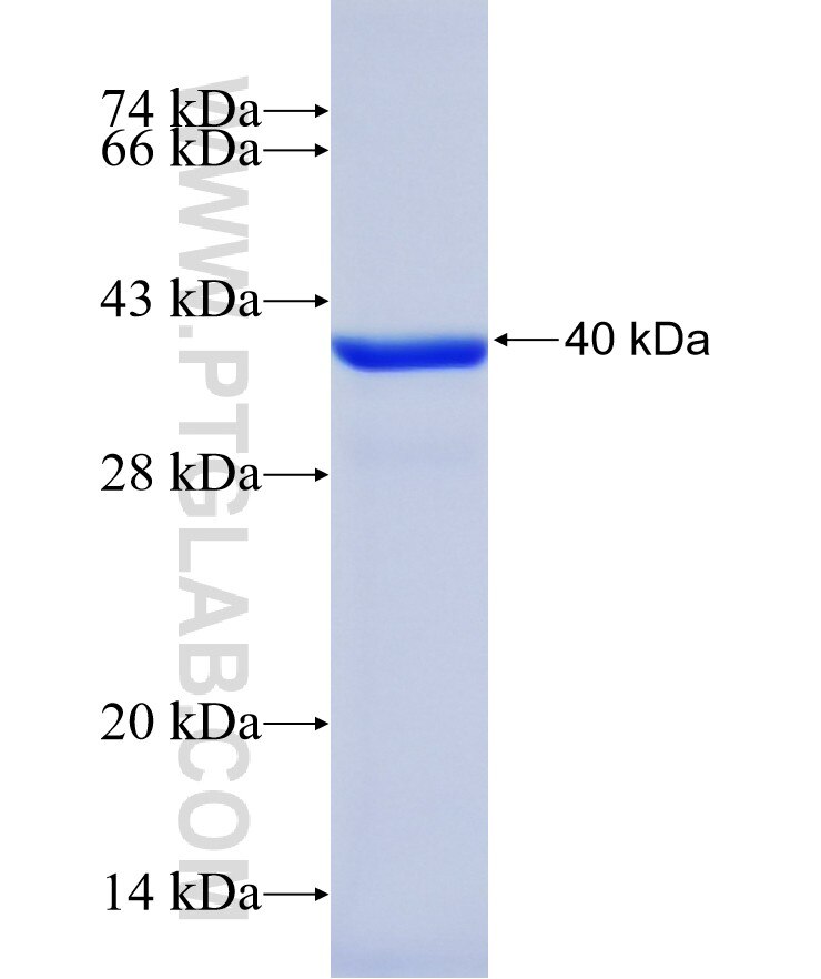 ANXA8 fusion protein Ag39741 SDS-PAGE