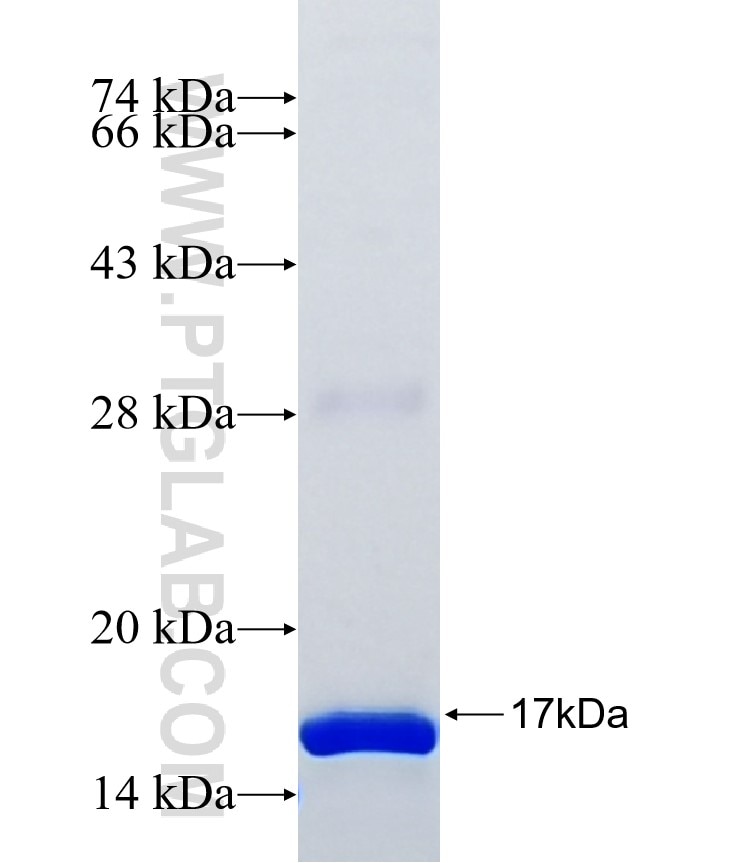 ANXA8L1 fusion protein Ag37919 SDS-PAGE ANXA8L1 fusion protein Ag37919 SDS-PAGE