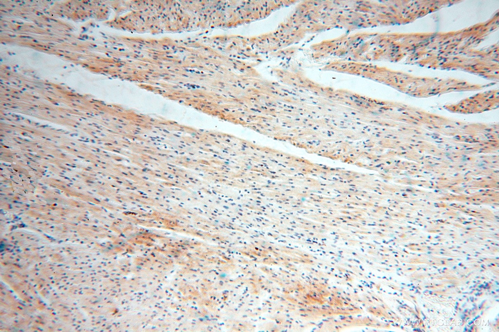 IHC staining of human heart using 15416-1-AP