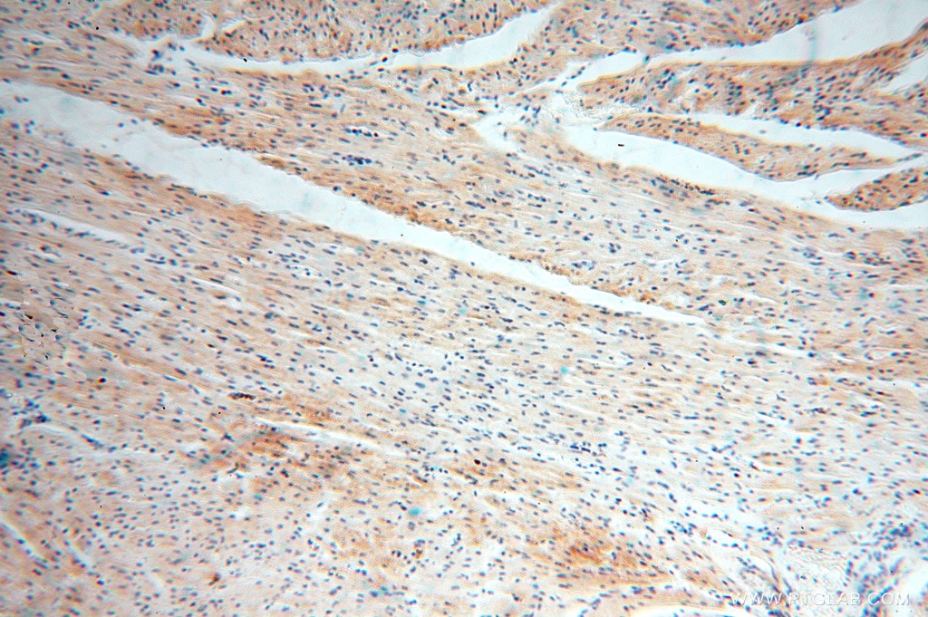 Immunohistochemistry (IHC) staining of human heart tissue using ANXA9 Polyclonal antibody (15416-1-AP)