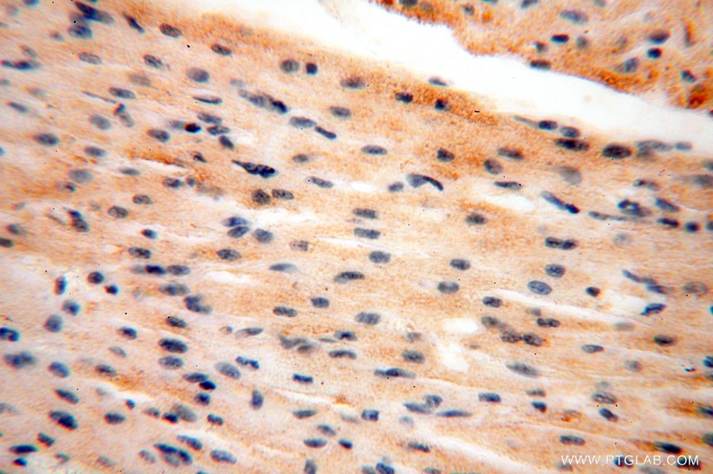 Immunohistochemistry (IHC) staining of human heart tissue using ANXA9 Polyclonal antibody (15416-1-AP)