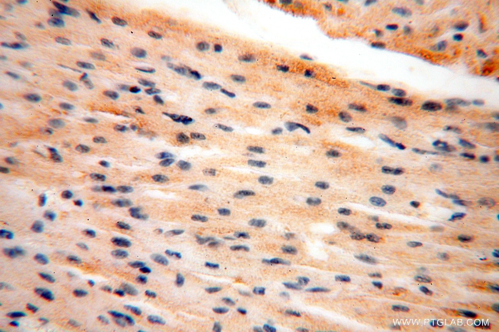 Immunohistochemistry (IHC) staining of human heart tissue using ANXA9 Polyclonal antibody (15416-1-AP)