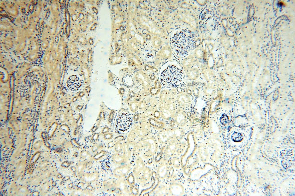 Immunohistochemistry (IHC) staining of human kidney tissue using ANXA9 Polyclonal antibody (15416-1-AP)