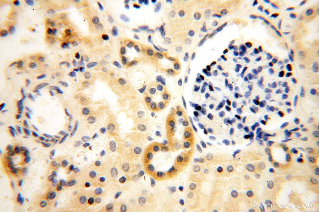 Immunohistochemistry (IHC) staining of human kidney tissue using ANXA9 Polyclonal antibody (15416-1-AP)
