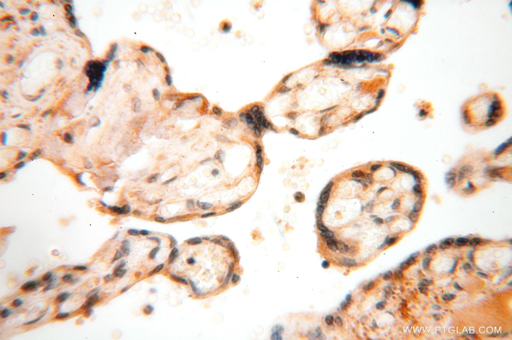 IHC staining of human placenta using 15416-1-AP