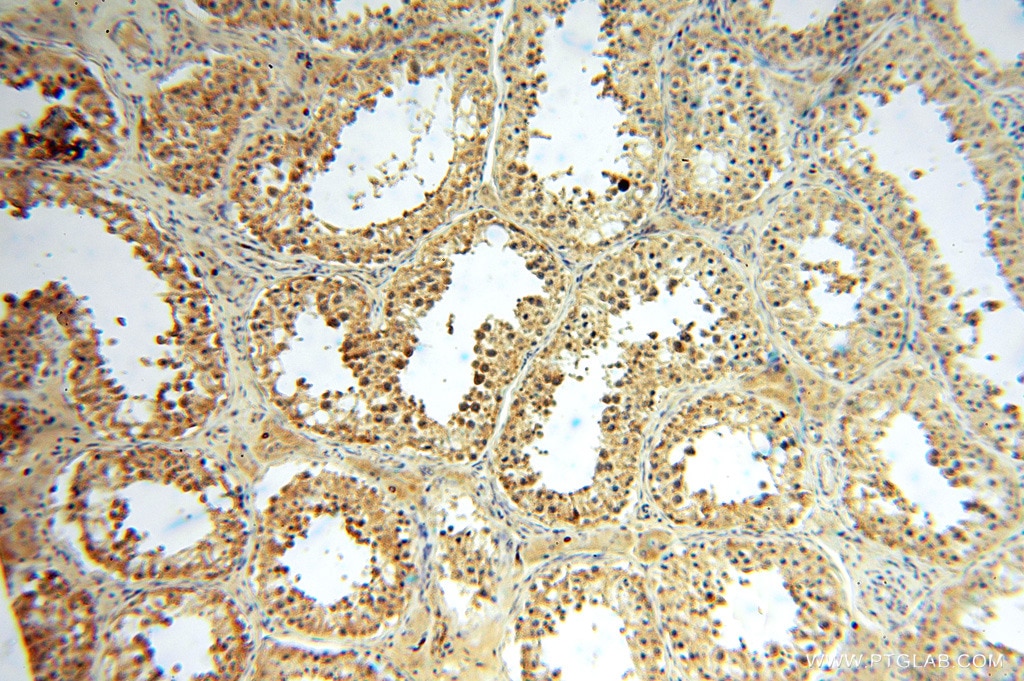 Immunohistochemistry (IHC) staining of human testis tissue using ANXA9 Polyclonal antibody (15416-1-AP)
