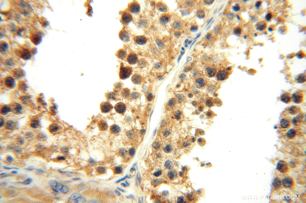 IHC staining of human testis using 15416-1-AP