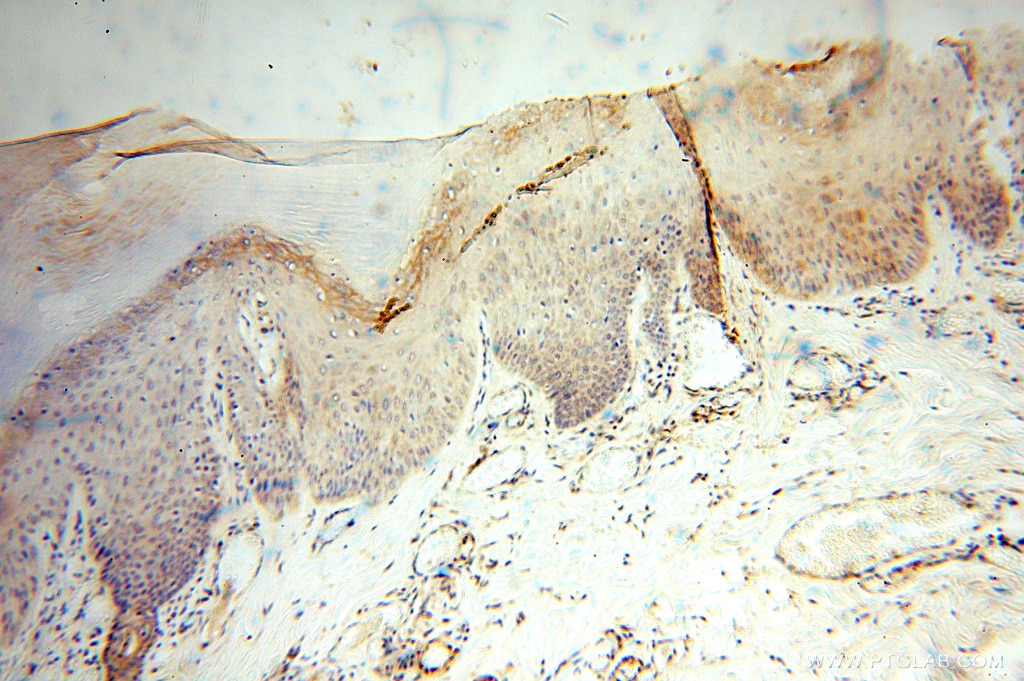 Immunohistochemistry (IHC) staining of human skin tissue using ANXA9 Polyclonal antibody (15416-1-AP)