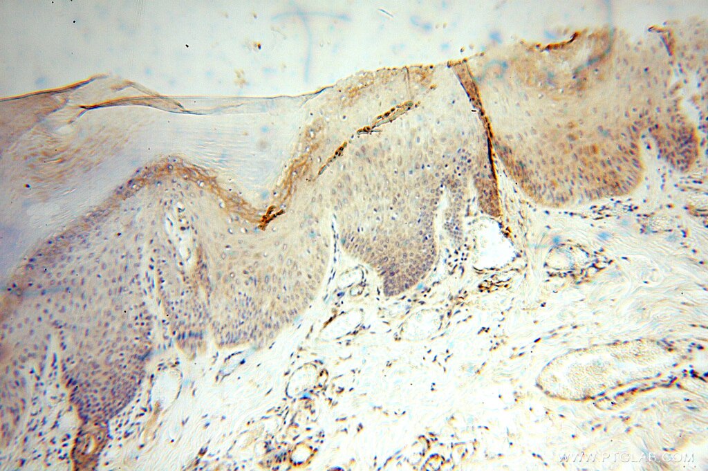 IHC staining of human skin using 15416-1-AP