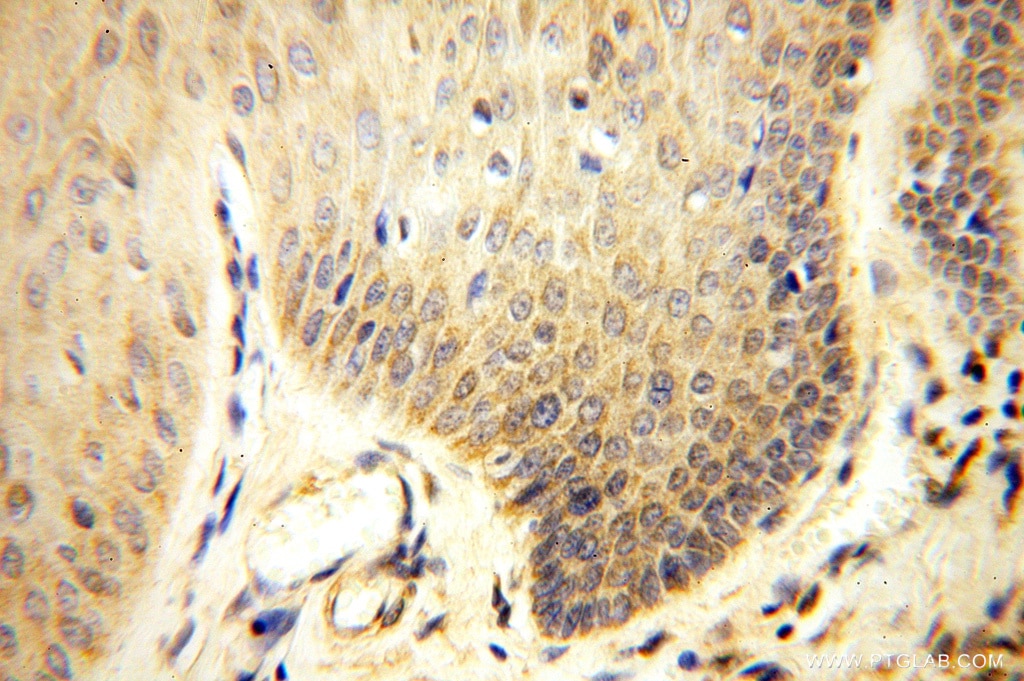 Immunohistochemistry (IHC) staining of human skin tissue using ANXA9 Polyclonal antibody (15416-1-AP)