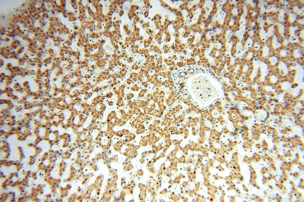 Immunohistochemistry (IHC) staining of human liver tissue using ANXA9 Polyclonal antibody (15416-1-AP)