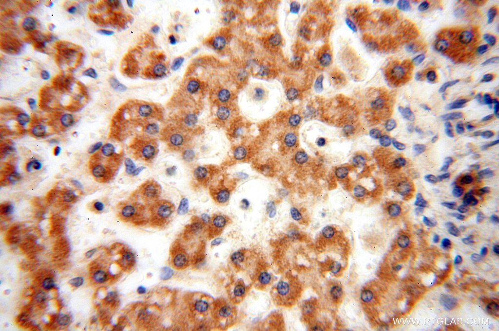 Immunohistochemistry (IHC) staining of human liver tissue using ANXA9 Polyclonal antibody (15416-1-AP)