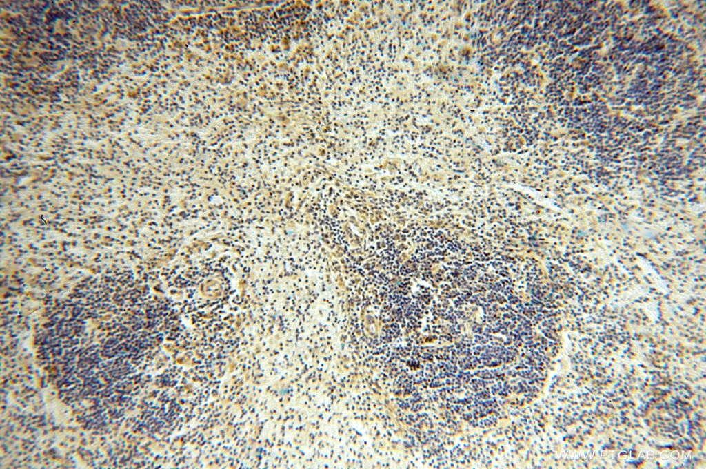 Immunohistochemistry (IHC) staining of human spleen tissue using ANXA9 Polyclonal antibody (15416-1-AP)