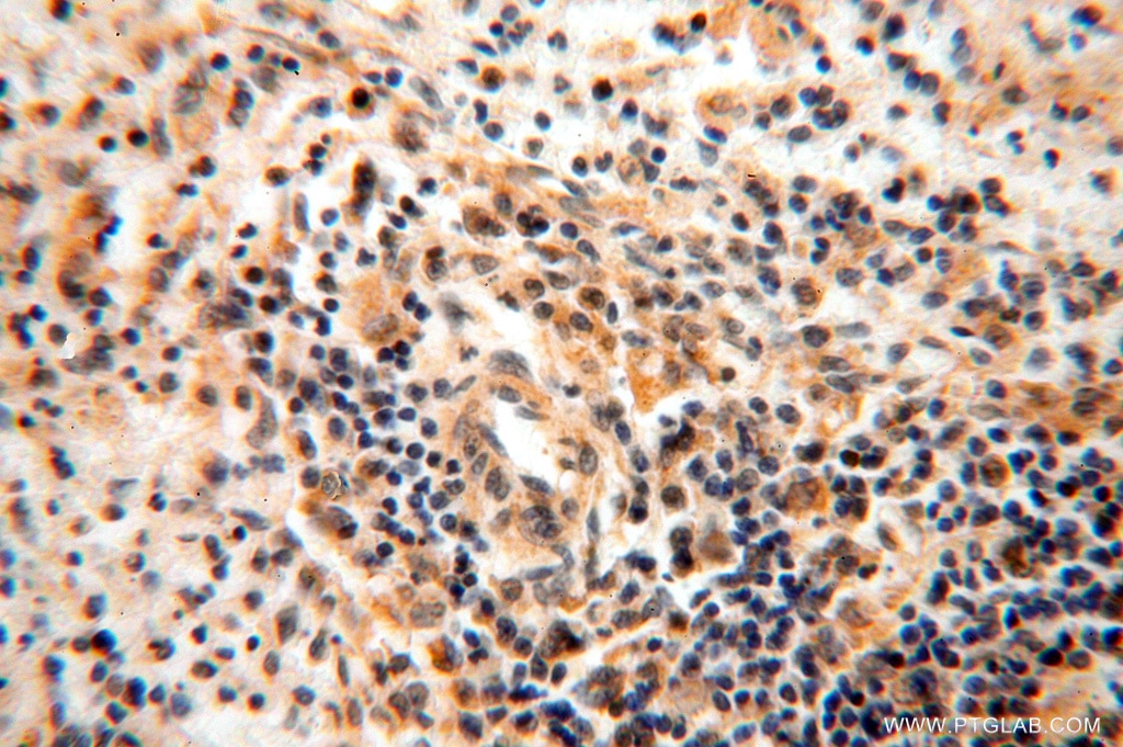 Immunohistochemistry (IHC) staining of human spleen tissue using ANXA9 Polyclonal antibody (15416-1-AP)