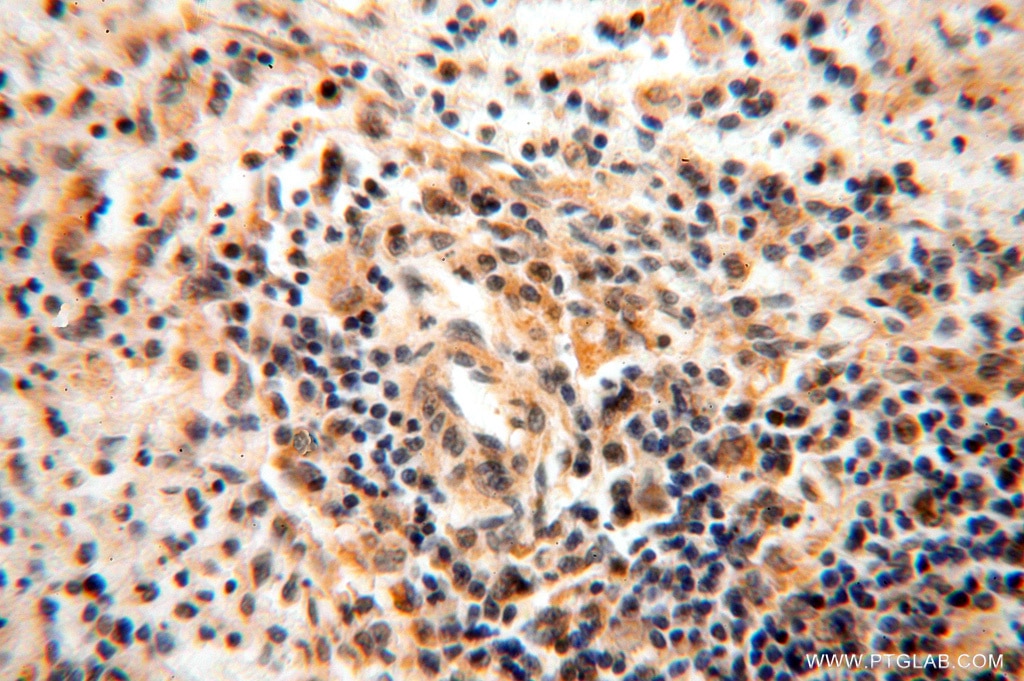 IHC staining of human spleen using 15416-1-AP