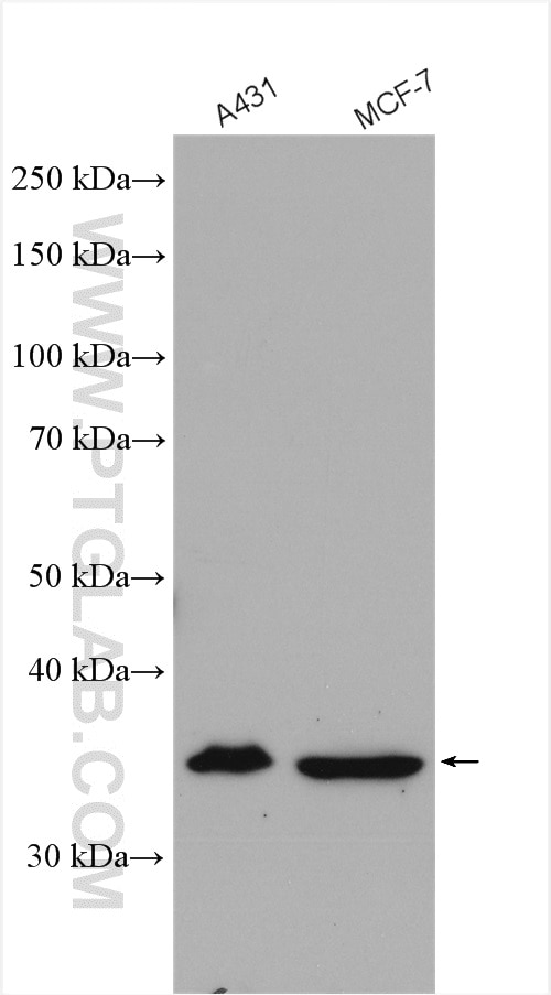 Western Blot (WB) analysis of various lysates using ANXA9 Polyclonal antibody (15416-1-AP)
